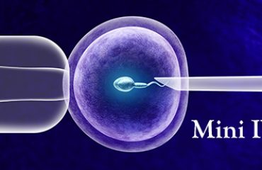 Mini IVF